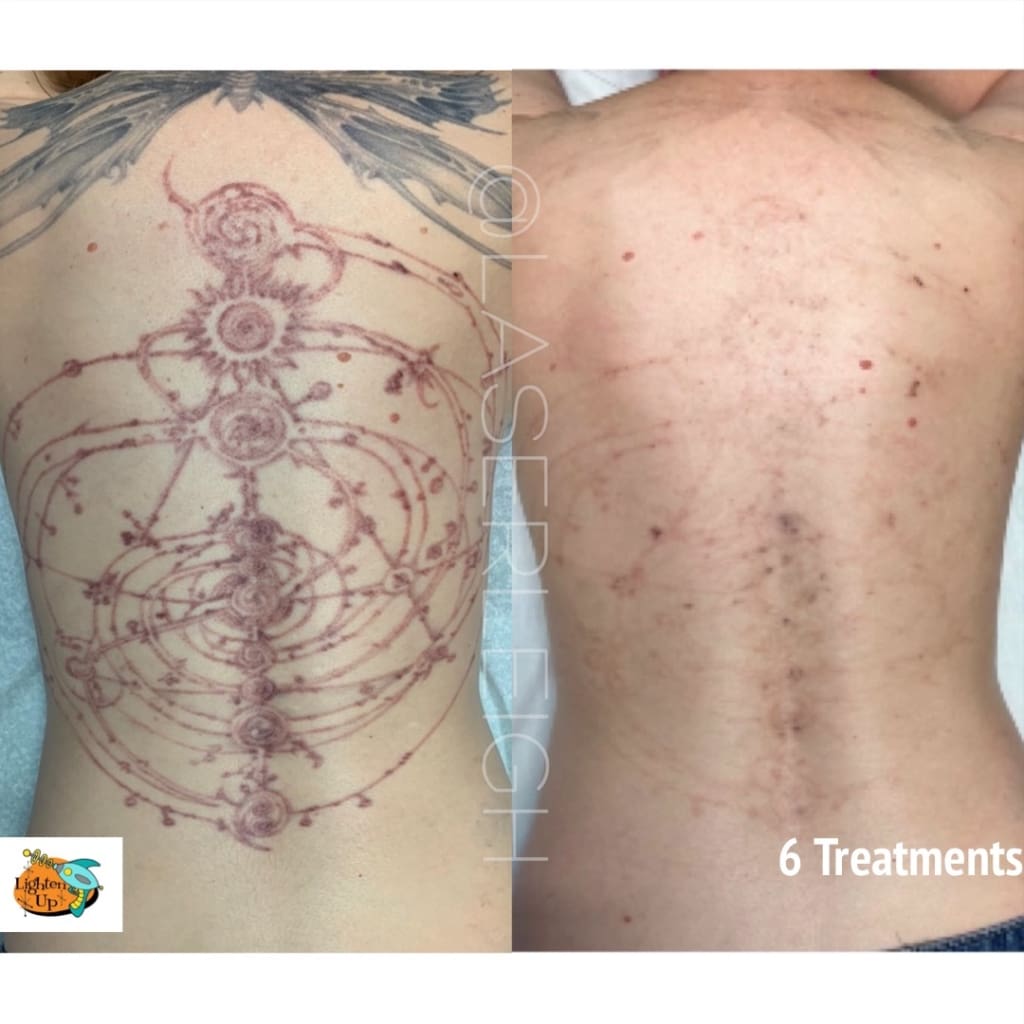 Red and Black ink removed in Phoenix using a laser